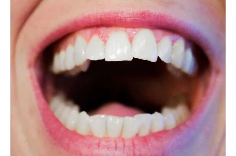 歯の種類と健康的な歯の保ち方