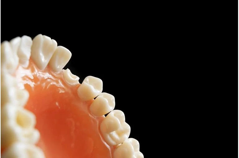 歯周病は歯茎に影響が出る？