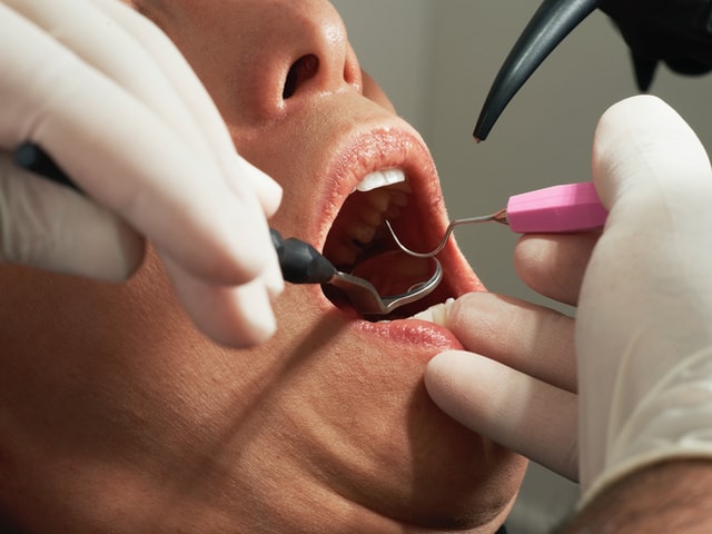 予防歯科の重要性とは？